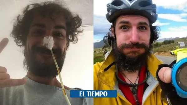 إرادة لا تعرف المستحيل.. عداء يعيش بلا معدة ولا قولون ولا مثانة (صور)