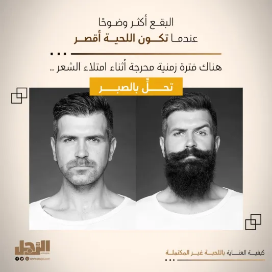 كيفية العناية باللحية غير المكتملة