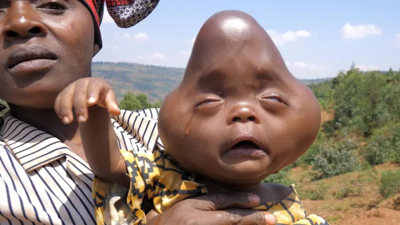 والده رغب في قتله ولقبه بالشيطان..قصة أغرب طفل في العالم (فيديو)