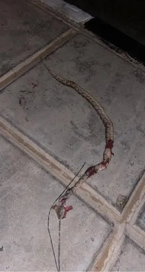 لدغة أفعى سامة تنقل طفلة في السعودية للعناية المركزة (صور) 