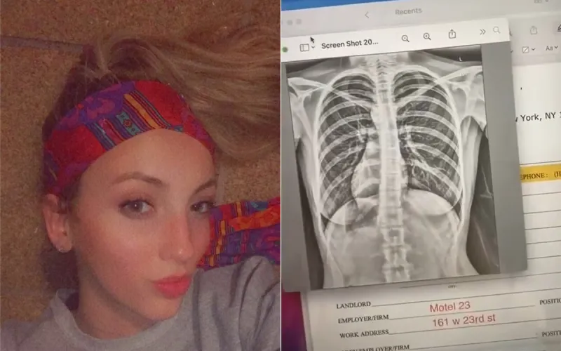 في حالة نادرة الحدوث فتاة تكتشف أن قلبها في جهة اليمين (فيديو)