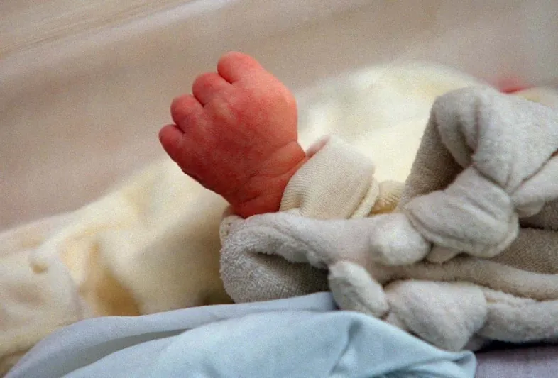 طفل يولد بذيل وكرة في نهايته والأطباء يفسرون الحالة (صور)