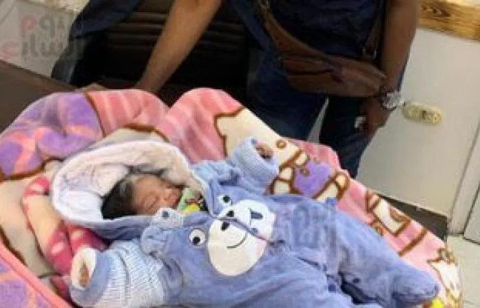 ولادة نادرة لطفل بدون جلد والأطباء يكشفون السبب (فيديو)