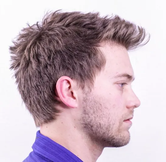 علاج تساقط الشعر.. حل لمشكلة تؤرق الكثير