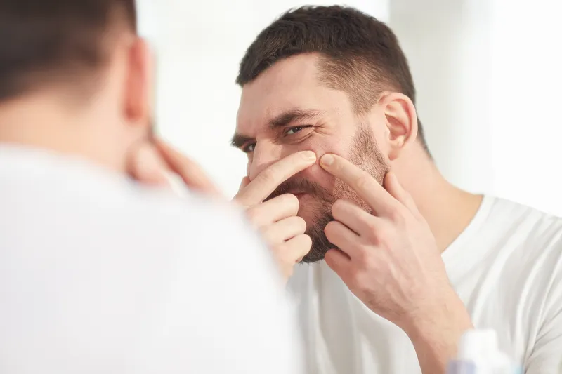 تعاني مشكلات البشرة الدهنية؟ وصفات مجربة وقواعد أساسية