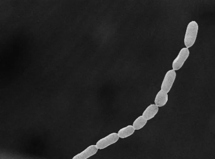 اكتشاف أكبر بكتيريا في العالم.. فهل تشكل خطرًا على البشر؟