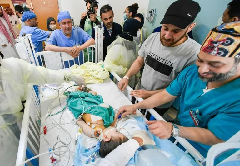 نجاح فصل التوأم السيامي السوري "إحسان وبسام" بالمملكة (صور)