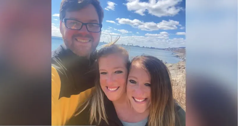 زواج أشهر توأم ملتصق في العالم من جندي أمريكي سابق