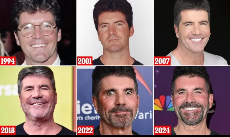 بعمر الـ65 عامًا.. هل خضع سايمون كويل لجراحة تجميل؟
