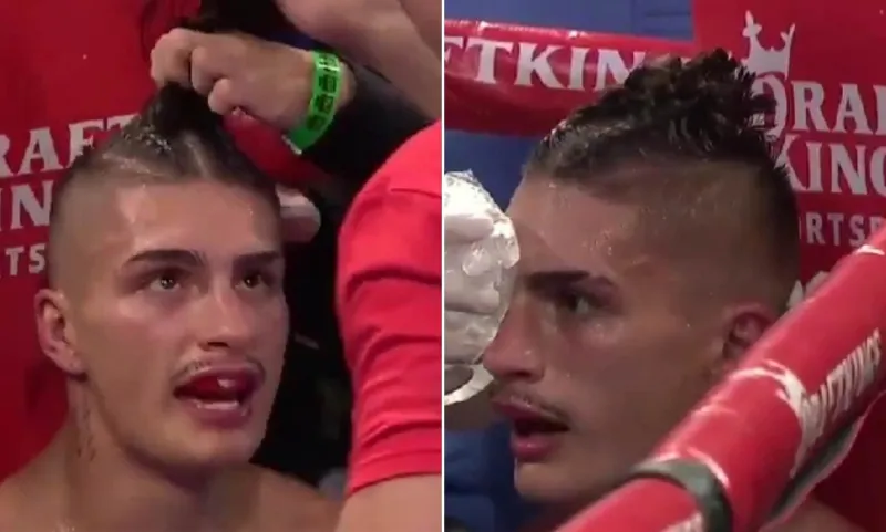  تحدٍّ فريد.. ملاكم يقص شعره في نزال ويفوز بالإجماع (فيديو)