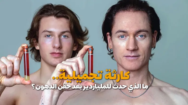 كارثة تجميلية.. ما الذي حدث للملياردير بعد حقن الدهون؟ (فيديوجراف)