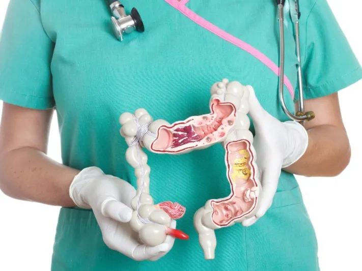 دراسة حديثة: النشاط البدني قد يطيل عمر مرضى سرطان القولون