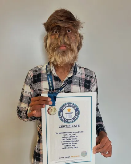 مراهق هندي يدخل جينيس بأكثر وجه مشعر في العالم  (فيديو)