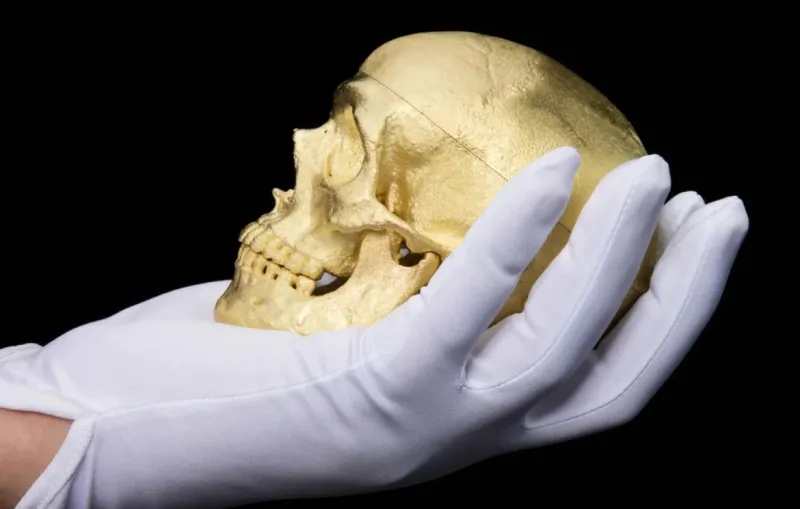 جمجمة ذهبية في مزاد.. الطبيب الذي حوّل رأسه إلى عمل فني