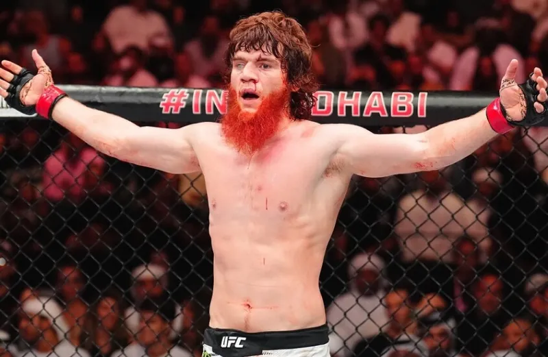 إصابة مقلقة لشارابوتدين محمدوف بعد نزال UFC.. كسر في الأنف وجراحة مرتقبة