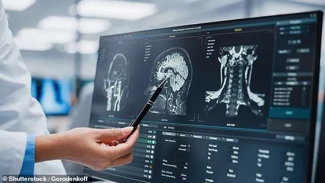 قلة النوم تهدد دماغك.. ودراسة توضح الرابط مع الخرف وألزهايمر