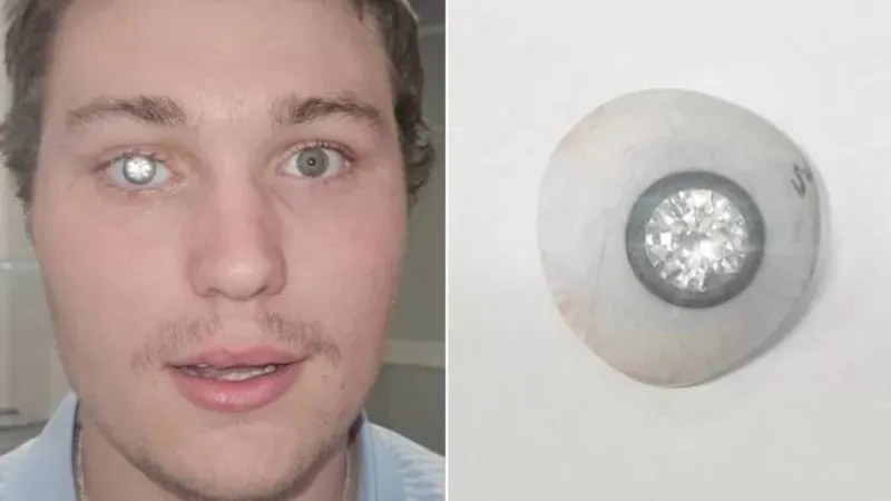 مرصعة بألماسة حقيقية.. القصة الكاملة لأغلى عين اصطناعية في العالم (فيديو)