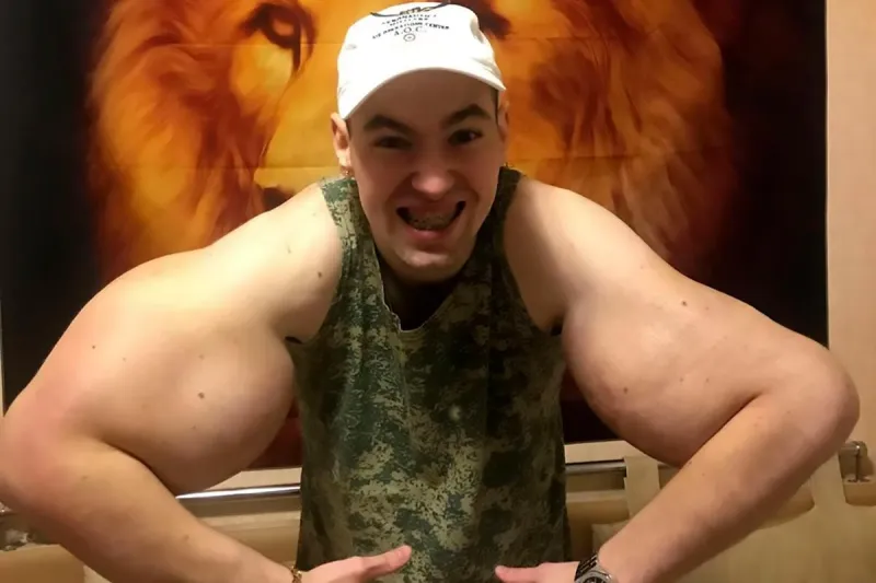 ماذا حدث لـ"باباي الروسي" بعد حقنه بالسينثول؟