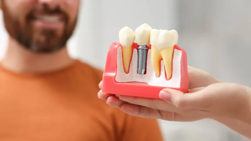 اللثة والدماغ على خط الاتصال: كيف يؤثر التهاب الفم المزمن على الدماغ؟