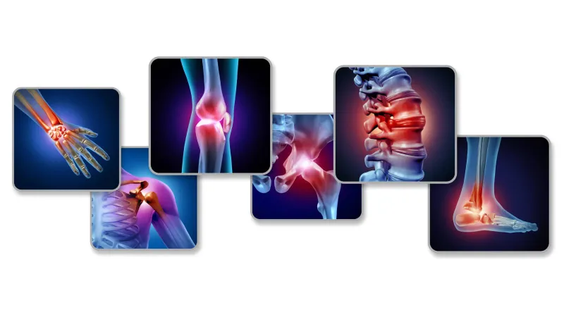 تقنية ثورية: ابتكار طبي جديد يعجّل التئام العظام دون جراحة إضافية