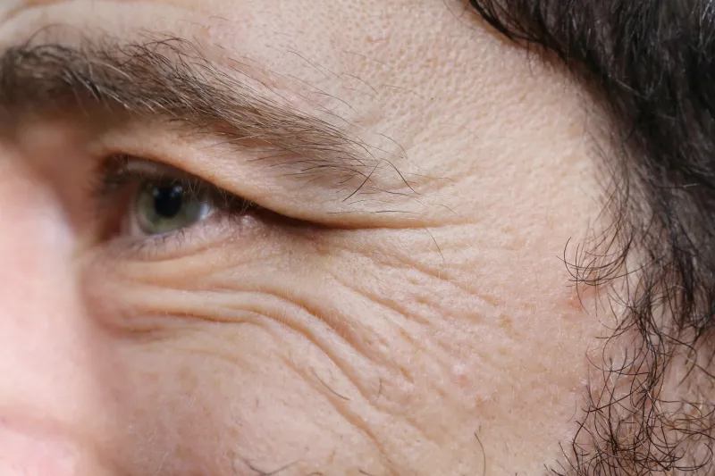 تجاعيد ما بعد الوسادة: أسرار حماية بشرتك من آثار النوم الخفية