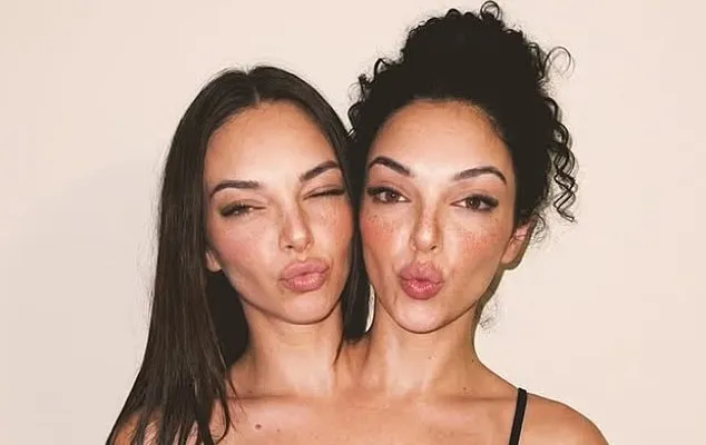 توأمان ملتصقان يخطفان الأضواء على إنستغرام.. والحقيقة مفاجأة (فيديو)