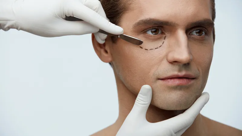 لماذا تتزايد عمليات تجميل الرجال؟ خبراء يوضّحون (فيديو)