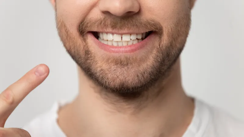 دراسة: الضحك على الأخطاء البسيطة يرفع جاذبيتك الاجتماعية