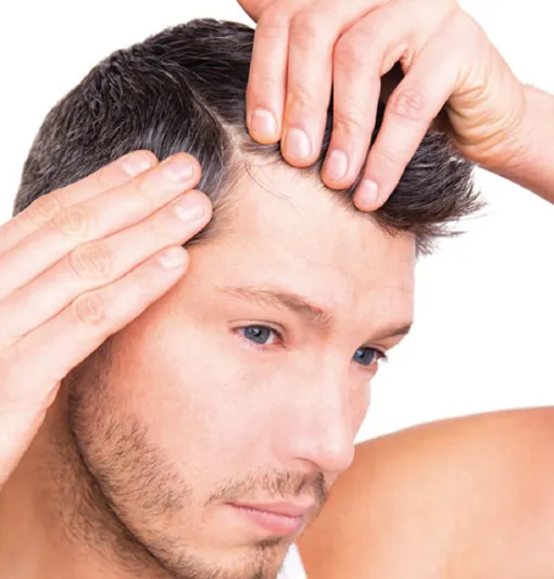دراسة تحذر من زراعة الشعر للرجال في عشرينات عمرهم. دراسة تحذر من زراعة الشعر للرجال في عشرينات عمرهم.