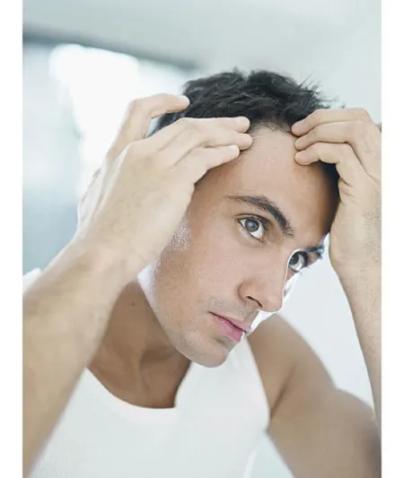 كيف تتعامل مع فقدان الشعر