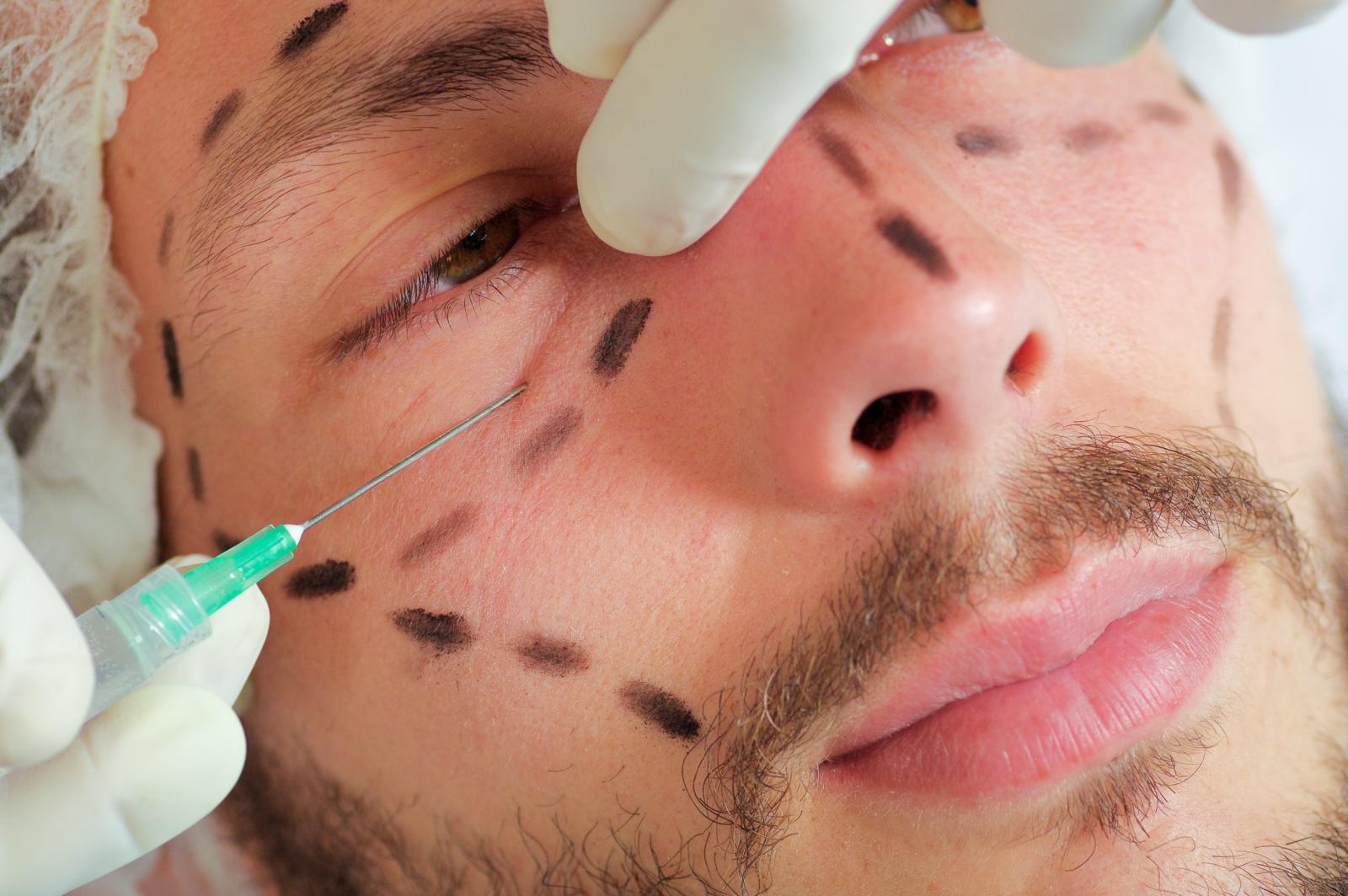 عزّزت وسائل التواصل الاجتماعي الرغبة في جراحات التجميل