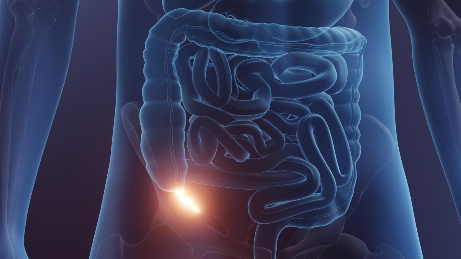 الزائدة الدودية  عضو حيوي في الجسم 